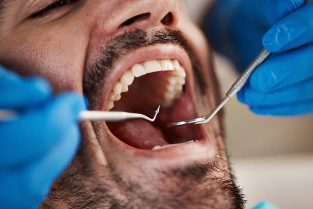 Best Emergency Dental Care for Sports Injuries in Bath, PA