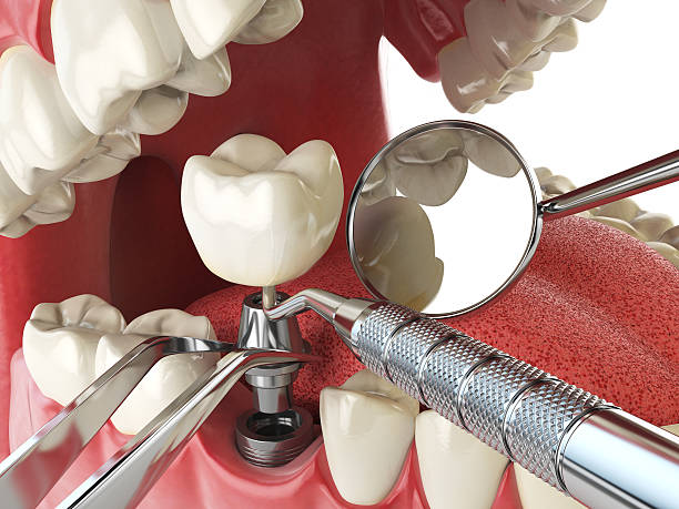 Best Emergency Denture Repair in Bath, PA
